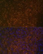 UGT1A6 Antibody in Immunohistochemistry (Paraffin) (IHC (P))