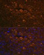 UGT1A6 Antibody in Immunohistochemistry (Paraffin) (IHC (P))