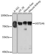 UGT1A6 Antibody in Western Blot (WB)