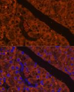 CELA2A Antibody in Immunohistochemistry (Paraffin) (IHC (P))