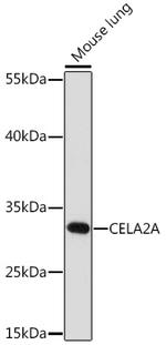 CELA2A Antibody in Western Blot (WB)