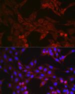 GSDMD Antibody in Immunocytochemistry (ICC/IF)