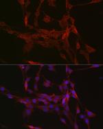 GSDMD Antibody in Immunocytochemistry (ICC/IF)