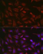 GSDMD Antibody in Immunocytochemistry (ICC/IF)