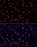 Lamin A/C Antibody in Immunocytochemistry (ICC/IF)