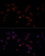 Lamin A/C Antibody in Immunocytochemistry (ICC/IF)