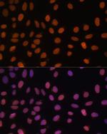 Lamin A/C Antibody in Immunocytochemistry (ICC/IF)