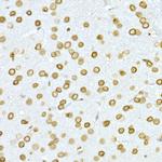 Lamin A/C Antibody in Immunohistochemistry (Paraffin) (IHC (P))