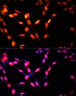 Myogenin Antibody in Immunocytochemistry (ICC/IF)