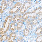 COG1 Antibody in Immunohistochemistry (Paraffin) (IHC (P))