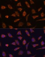 CAMSAP1 Antibody in Immunocytochemistry (ICC/IF)