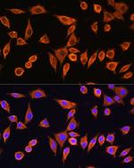 RPS28 Antibody in Immunocytochemistry (ICC/IF)