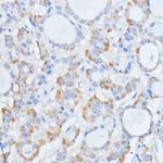 RALGDS Antibody in Immunohistochemistry (Paraffin) (IHC (P))