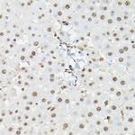 FOXO1/FOXO3/FOXO4 Antibody in Immunohistochemistry (Paraffin) (IHC (P))