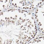 FOXO1/FOXO3/FOXO4 Antibody in Immunohistochemistry (Paraffin) (IHC (P))