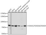 FOXO1/FOXO3/FOXO4 Antibody in Western Blot (WB)