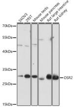 OSR2 Antibody in Western Blot (WB)