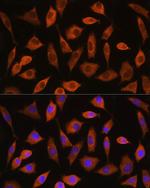 EIF2B4 Antibody in Immunocytochemistry (ICC/IF)