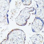 HSPB11 Antibody in Immunohistochemistry (Paraffin) (IHC (P))