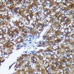 GRSF1 Antibody in Immunohistochemistry (Paraffin) (IHC (P))