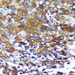 GRSF1 Antibody in Immunohistochemistry (Paraffin) (IHC (P))