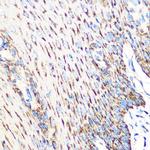 OSR1 Antibody in Immunohistochemistry (Paraffin) (IHC (P))