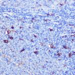 GSDMD Antibody in Immunohistochemistry (Paraffin) (IHC (P))