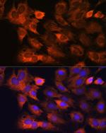 RPS8 Antibody in Immunocytochemistry (ICC/IF)