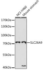 SLC26A9 Antibody in Western Blot (WB)