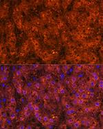 ADH1A/ADH1B/ADH1C Antibody in Immunohistochemistry (Paraffin) (IHC (P))