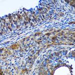 TSN Antibody in Immunohistochemistry (Paraffin) (IHC (P))