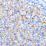 ZMPSTE24 Antibody in Immunohistochemistry (Paraffin) (IHC (P))