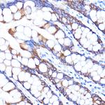 ZMPSTE24 Antibody in Immunohistochemistry (Paraffin) (IHC (P))