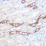 WWC2 Antibody in Immunohistochemistry (Paraffin) (IHC (P))