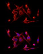 VDAC2 Antibody in Immunocytochemistry (ICC/IF)