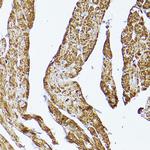 VDAC2 Antibody in Immunohistochemistry (Paraffin) (IHC (P))