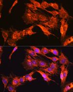 TrkA/TrkB/TrkC Antibody in Immunocytochemistry (ICC/IF)