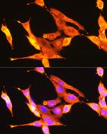 TrkA/TrkB/TrkC Antibody in Immunocytochemistry (ICC/IF)