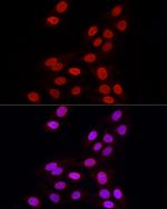 Lamin B1 Antibody in Immunocytochemistry (ICC/IF)