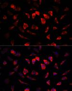 IGFBP4 Antibody in Immunocytochemistry (ICC/IF)