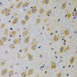 IGFBP4 Antibody in Immunohistochemistry (Paraffin) (IHC (P))