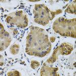 IGFBP4 Antibody in Immunohistochemistry (Paraffin) (IHC (P))