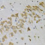 IGFBP4 Antibody in Immunohistochemistry (Paraffin) (IHC (P))