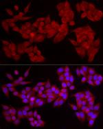 PDE4A Antibody in Immunocytochemistry (ICC/IF)