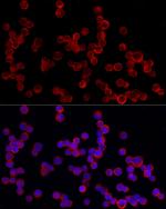 PDE4A Antibody in Immunocytochemistry (ICC/IF)