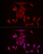 PDE4A Antibody in Immunocytochemistry (ICC/IF)