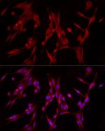 PDE4A Antibody in Immunocytochemistry (ICC/IF)