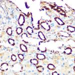 PDE4A Antibody in Immunohistochemistry (Paraffin) (IHC (P))