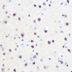 ZNF207 Antibody in Immunohistochemistry (Paraffin) (IHC (P))