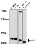 BRP44L Antibody in Western Blot (WB)